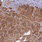 PEX3 Antibody in Immunohistochemistry (Paraffin) (IHC (P))