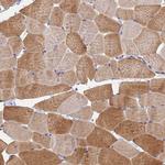 PEX3 Antibody in Immunohistochemistry (Paraffin) (IHC (P))