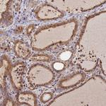 PEX3 Antibody in Immunohistochemistry (Paraffin) (IHC (P))