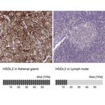 HSDL2 Antibody