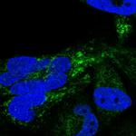 HSDL2 Antibody in Immunocytochemistry (ICC/IF)