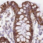 HSDL2 Antibody in Immunohistochemistry (Paraffin) (IHC (P))