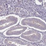 HAGH Antibody in Immunohistochemistry (Paraffin) (IHC (P))