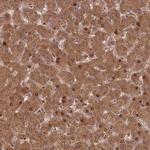 HAGH Antibody in Immunohistochemistry (Paraffin) (IHC (P))