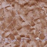 HAGH Antibody in Immunohistochemistry (Paraffin) (IHC (P))