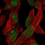 KGF Antibody in Immunocytochemistry (ICC/IF)