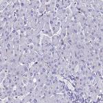 KGF Antibody in Immunohistochemistry (Paraffin) (IHC (P))