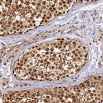 PPP4C Antibody in Immunohistochemistry (Paraffin) (IHC (P))