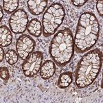 PPP4C Antibody in Immunohistochemistry (Paraffin) (IHC (P))