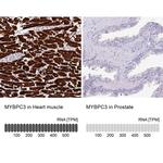 MYBPC3 Antibody