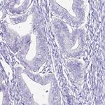 MYBPC3 Antibody in Immunohistochemistry (Paraffin) (IHC (P))