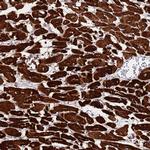 MYBPC3 Antibody in Immunohistochemistry (Paraffin) (IHC (P))