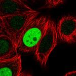 RACGAP1 Antibody in Immunocytochemistry (ICC/IF)