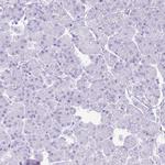 RACGAP1 Antibody in Immunohistochemistry (Paraffin) (IHC (P))