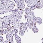 RACGAP1 Antibody in Immunohistochemistry (Paraffin) (IHC (P))