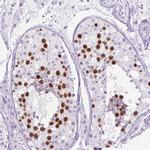 RACGAP1 Antibody in Immunohistochemistry (Paraffin) (IHC (P))