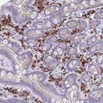 J Chain Antibody in Immunohistochemistry (Paraffin) (IHC (P))