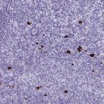 J Chain Antibody in Immunohistochemistry (Paraffin) (IHC (P))