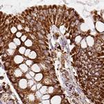 ATP5A1 Antibody in Immunohistochemistry (Paraffin) (IHC (P))