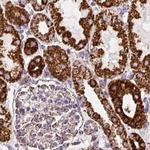 ATP5A1 Antibody in Immunohistochemistry (Paraffin) (IHC (P))