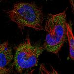 alanyl-tRNA Synthetase Antibody in Immunocytochemistry (ICC/IF)