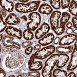 TRAP1 Antibody in Immunohistochemistry (Paraffin) (IHC (P))