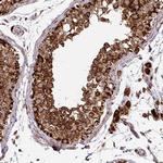 TRAP1 Antibody in Immunohistochemistry (Paraffin) (IHC (P))