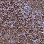 FDXR Antibody in Immunohistochemistry (Paraffin) (IHC (P))