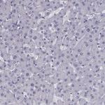 FDXR Antibody in Immunohistochemistry (Paraffin) (IHC (P))