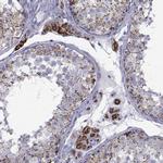 FDXR Antibody in Immunohistochemistry (Paraffin) (IHC (P))