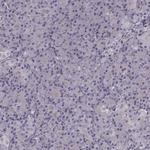 PKC epsilon Antibody in Immunohistochemistry (Paraffin) (IHC (P))