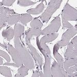 PKC epsilon Antibody in Immunohistochemistry (Paraffin) (IHC (P))