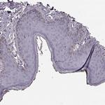 PKC epsilon Antibody in Immunohistochemistry (Paraffin) (IHC (P))