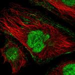 Cardiac Troponin C Antibody in Immunocytochemistry (ICC/IF)