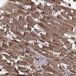 Cardiac Troponin C Antibody in Immunohistochemistry (Paraffin) (IHC (P))