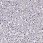 Cardiac Troponin C Antibody in Immunohistochemistry (Paraffin) (IHC (P))