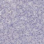 Cardiac Troponin C Antibody in Immunohistochemistry (Paraffin) (IHC (P))