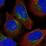 COPD Antibody in Immunocytochemistry (ICC/IF)