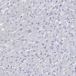 Cytokeratin 17 Antibody in Immunohistochemistry (Paraffin) (IHC (P))