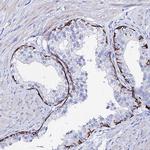 Cytokeratin 17 Antibody in Immunohistochemistry (Paraffin) (IHC (P))