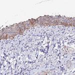 Cytokeratin 17 Antibody in Immunohistochemistry (Paraffin) (IHC (P))