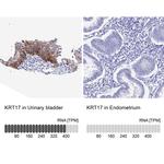 Cytokeratin 17 Antibody