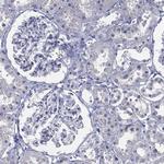 CYP2D6 Antibody in Immunohistochemistry (Paraffin) (IHC (P))