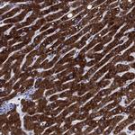 CYP2D6 Antibody in Immunohistochemistry (Paraffin) (IHC (P))