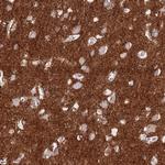 ATP1A3 Antibody in Immunohistochemistry (Paraffin) (IHC (P))