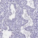 ATP1A3 Antibody in Immunohistochemistry (Paraffin) (IHC (P))