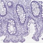 ATP4B Antibody in Immunohistochemistry (Paraffin) (IHC (P))