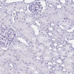 ATP4B Antibody in Immunohistochemistry (Paraffin) (IHC (P))