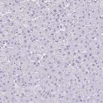 ATP4B Antibody in Immunohistochemistry (Paraffin) (IHC (P))