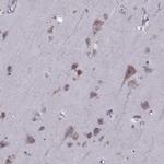 PABPC1 Antibody in Immunohistochemistry (Paraffin) (IHC (P))